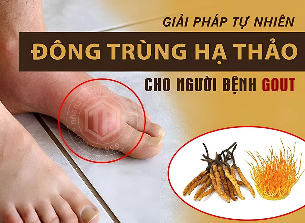 Đông trùng hạ thảo hỗ trợ giảm đau, sưng viêm do Gout